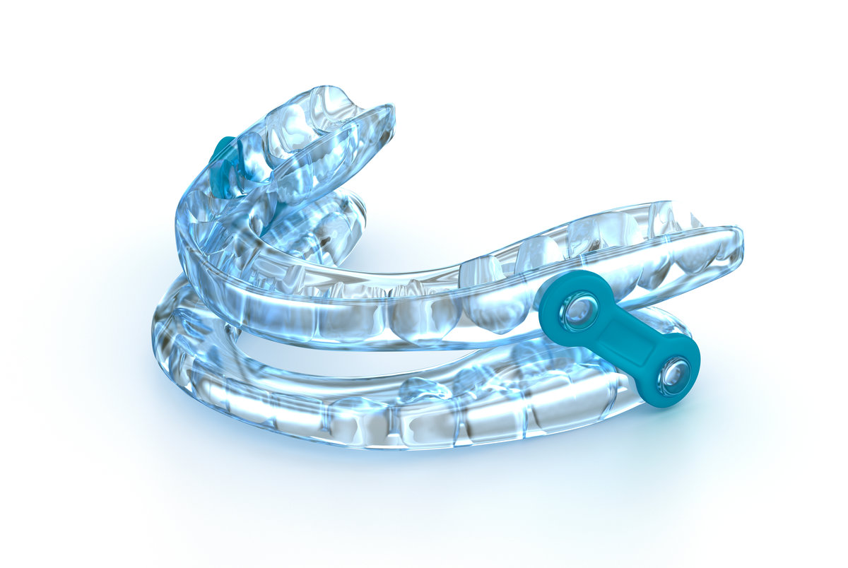 Oral appliance therapy device, sleep apnea treatment. 3D illustration