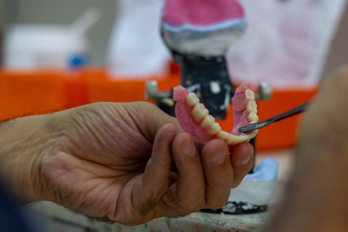 denture making
